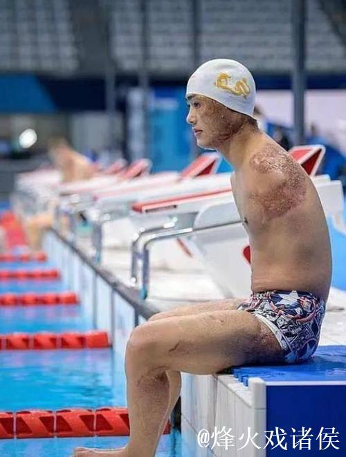 残特奥会聚焦|“无臂飞鱼”袁伟译:跨越人生新起点 残特奥会聚焦|“无臂飞鱼”袁伟译:跨越人生新起点